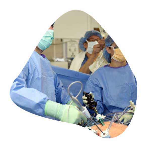 Cirugía laparoscópica avanzada